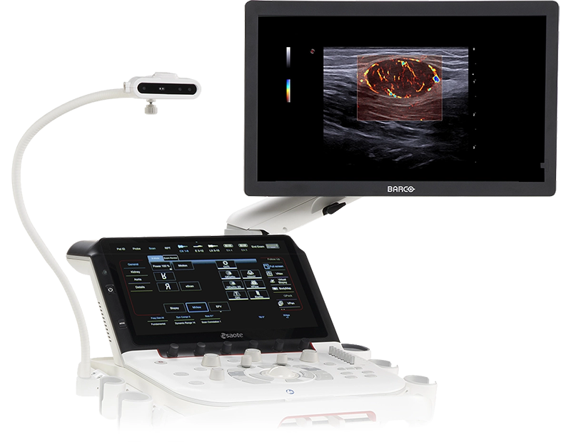 Nuovo Ecografo MyLab X90